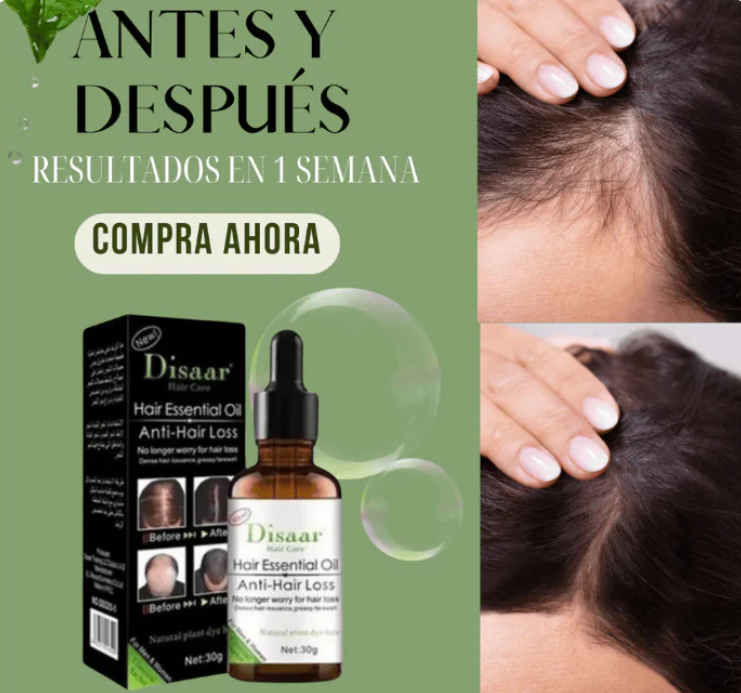 ACEITE ANTICAIDA Y CRECIMIENTO CAPILAR + SHAMPOO DE REGALO😍🎁